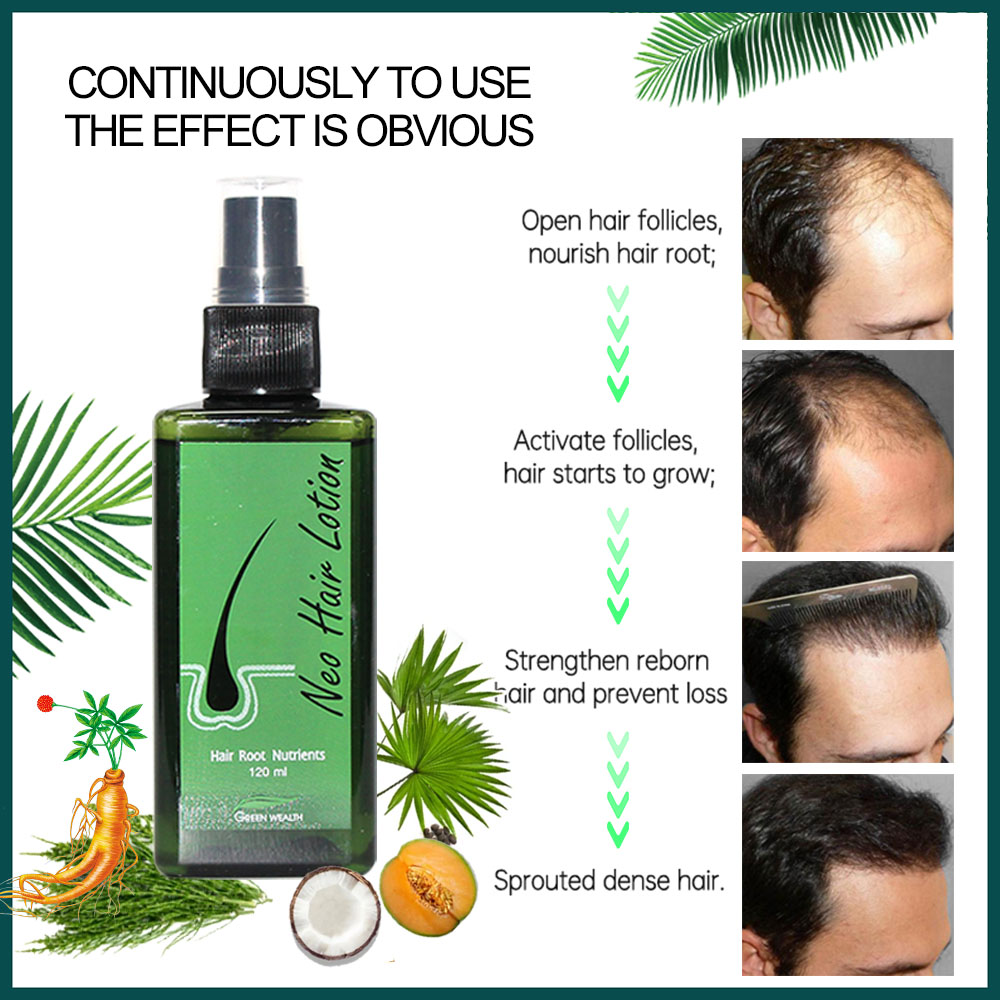 4 adet Neo Saç Losyonu 120ml S - Hair Care Basic incelemesi ve fiyatı