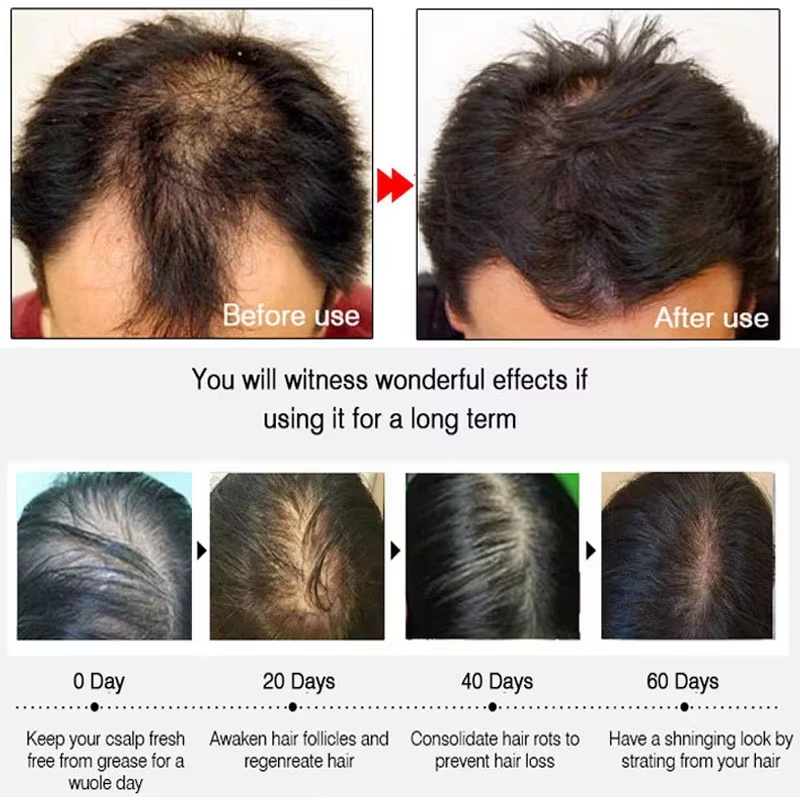 Hızlı Zencefilli Saç Uzatma Sp - Hair Growth Serum Oil incelemesi ve fiyatı